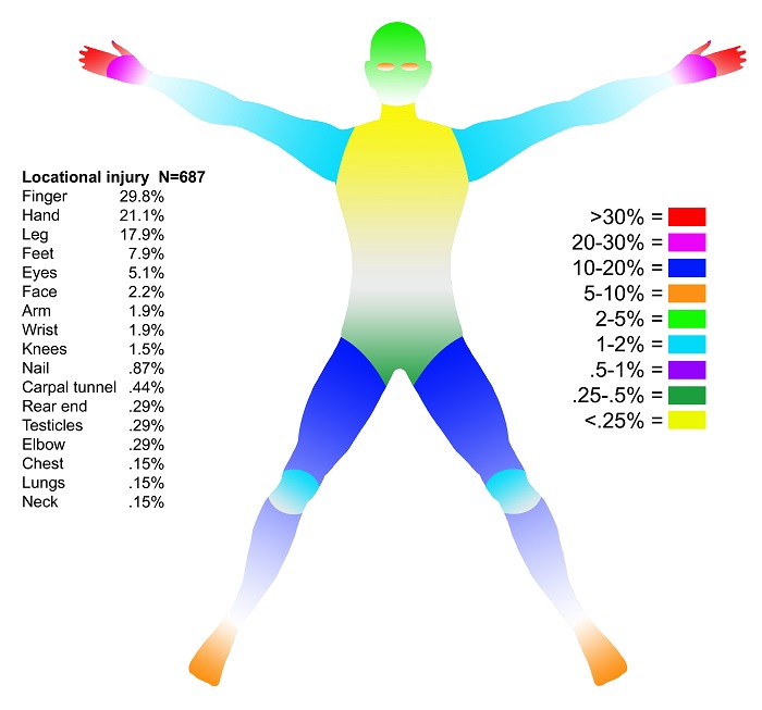 A color-coded figure illustrates that flintknapping injuries are not just limited to the hands. A color-coded figure illustrates that flintknapping injuries are not just limited to the hands.