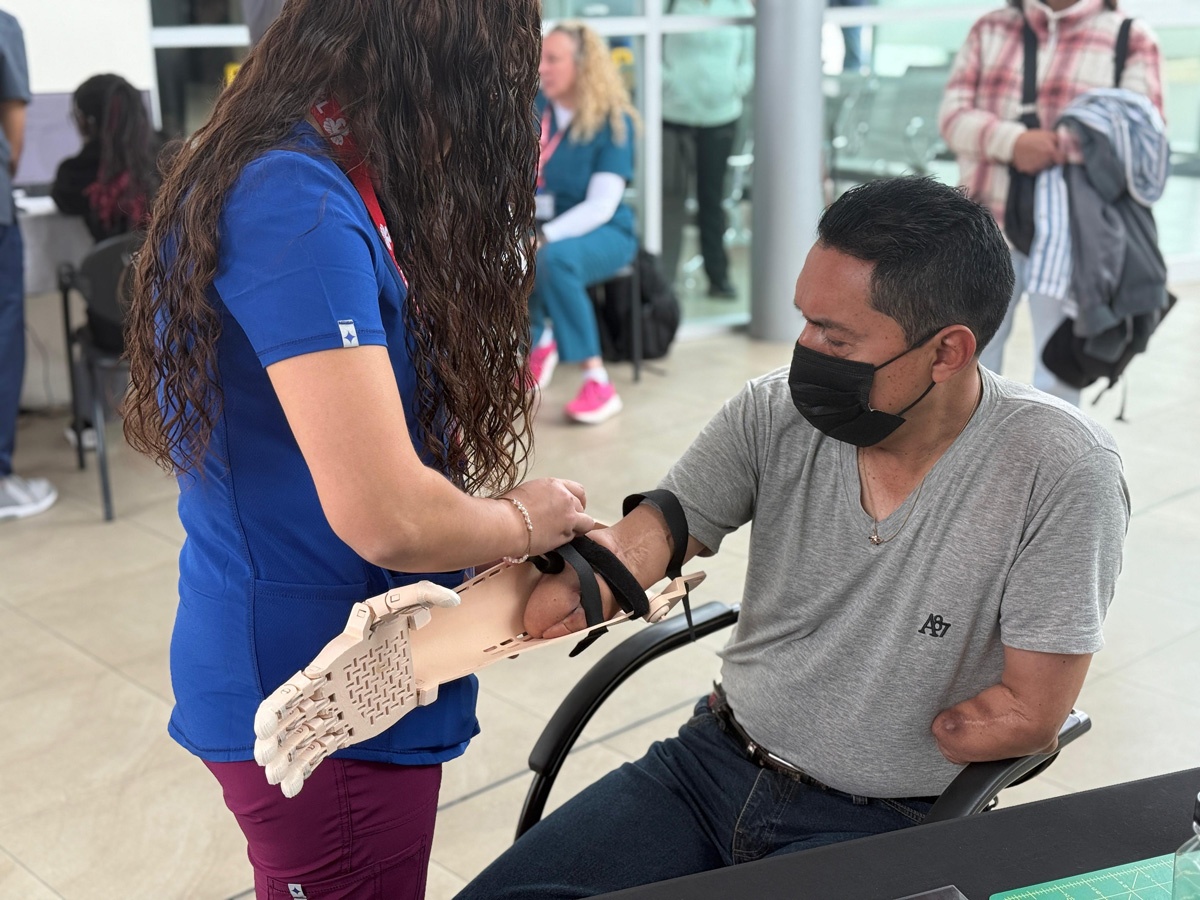 Yari helping to fit a prosthetic hand onto a patient