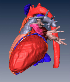 3D Anteriolateral view of human heart constructed from 2D data