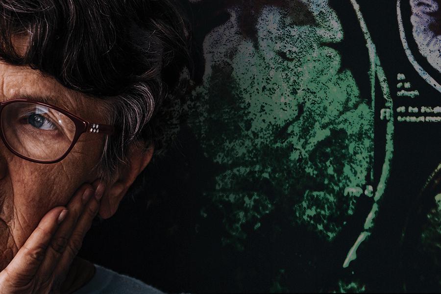 Image of a woman with Alzheimer's