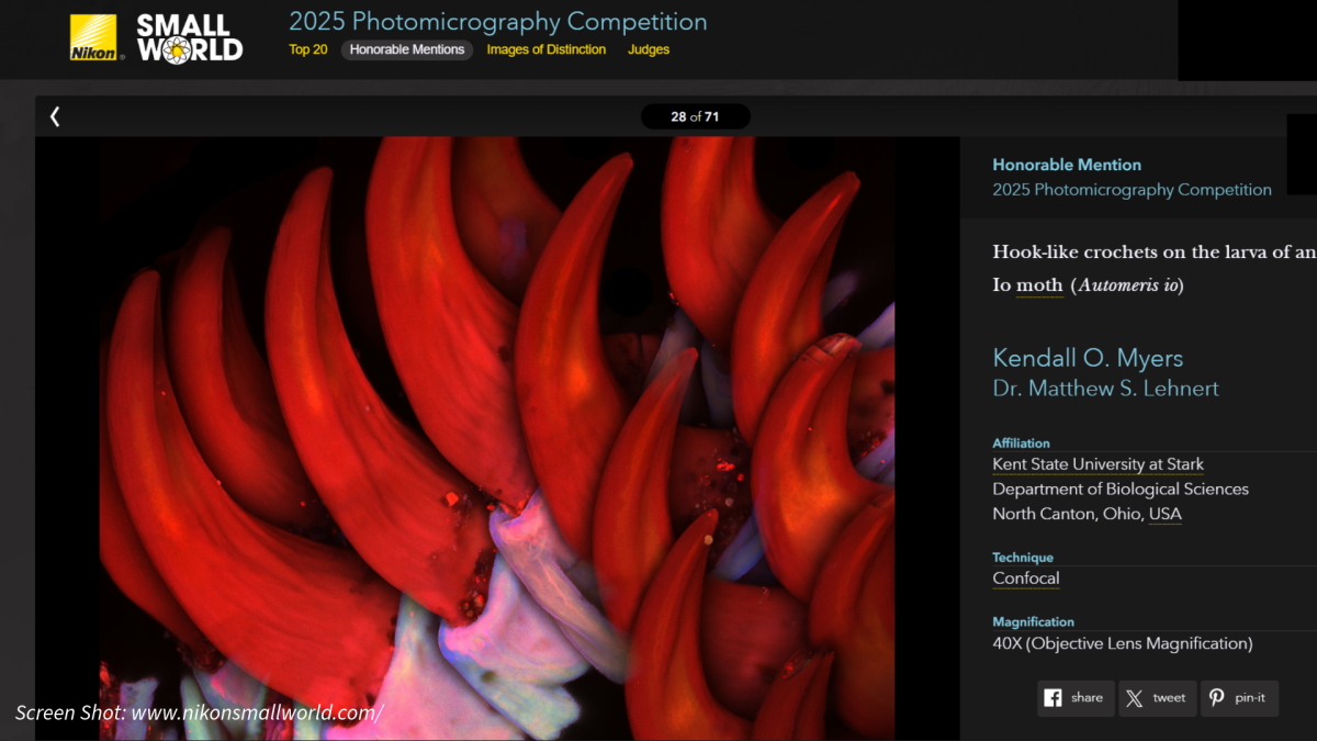 International Honorable Mention Photo - Hook-like Crochets on the Larva of an Io (Automeris io) Moth.鈥