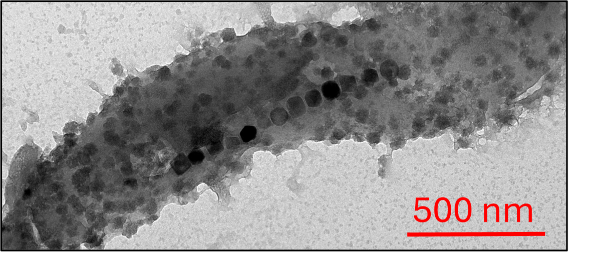 MTB image
