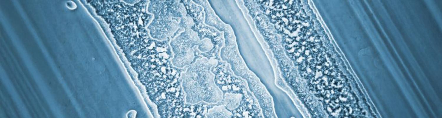 Under a magnification of 85X, and using phase contrast illumination, this photomicrograph highlighted some of the ultrastructural morphology exhibited by TP (transparent, proteolytic) phase, type F, Clostridium botulinum microorganisms in a heavy area of the streaked plate.